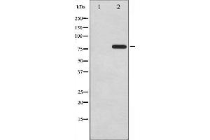 Western Blotting (WB) image for anti-Microtubule-Associated Protein tau (MAPT) (pSer396) antibody (ABIN6255298)