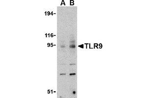 Western Blotting (WB) image for anti-Toll-Like Receptor 9 (TLR9) (C-Term) antibody (ABIN1030747) (TLR9 antibody  (C-Term))