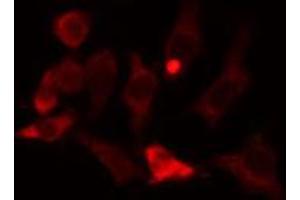 Immunofluorescence (fixed cells) (IF/ICC) image for anti-PDZ and LIM Domain 1 (PDLIM1) (Internal Region) antibody (ABIN6264117)