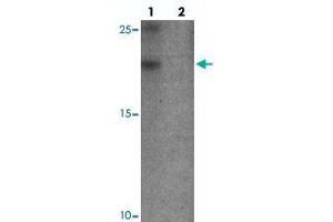Western blot analysis of YPEL3 in A-20 cell lysate with YPEL3 polyclonal antibody  at 1 ug/mL in (lane 1) the absence and (lane 2) the presence of blocking peptide. (YPEL3 antibody  (N-Term))