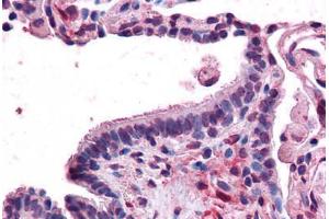 Human Lung, Respiratory Epithelium: Formalin-Fixed, Paraffin-Embedded (FFPE) (MFI2 antibody  (N-Term))