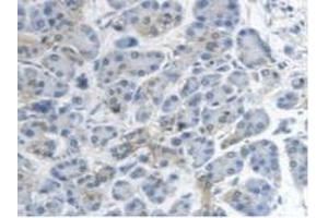 Detection of MTUS1 in Human Pancreas Tissue using Polyclonal Antibody to Mitochondrial Tumor Suppressor 1 (MTUS1) (MTUS1 antibody  (AA 1018-1270))