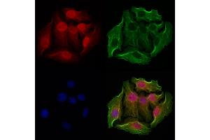 ABIN6263746 and ABIN6272947 staining Hela cells by IF/ICC.