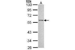 WB Image Sample (30 ug of whole cell lysate) A: A431 , 10% SDS PAGE antibody diluted at 1:3000 (ESRRG antibody)