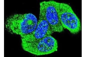 Immunofluorescence (IF) image for anti-HRas proto-oncogene, GTPase (HRAS) antibody (ABIN2996311) (HRAS antibody)