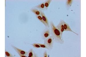 Immunocytochemistry analysis of Hela cells using ABIN7139620 at dilution of 1:100 (HIST1H1E antibody  (pSer35))