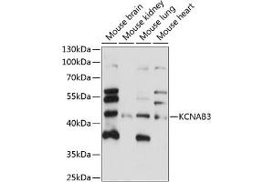 Western blot analysis of extracts of various cell lines, using KCN antibody (ABIN7269482) at 1:1000 dilution. (KCNAB3 antibody  (AA 285-404))