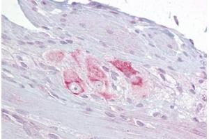 Anti-RBMS3 antibody IHC staining of human small intestine, myenteric plexus.