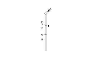 Anti-TXK Antibody (N-term) at 1:2000 dilution + U266B1 whole cell lysate Lysates/proteins at 20 μg per lane. (TXK antibody  (N-Term))