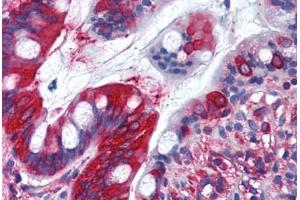 Human Small Intestine (formalin-fixed, paraffin-embedded) stained with TFG antibody ABIN290224 at 10 ug/ml followed by biotinylated goat anti-rabbit IgG secondary antibody ABIN481713, alkaline phosphatase-streptavidin and chromogen. (TFG antibody  (AA 350-400))