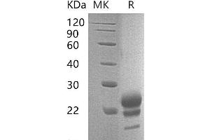 Western Blotting (WB) image for Interleukin 17F (IL17F) protein (His tag) (ABIN7320578) (IL17F Protein (His tag))