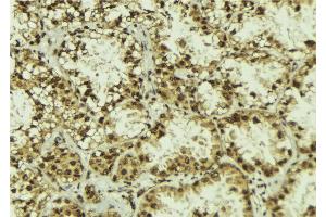 ABIN6272855 at 1/100 staining Human lung tissue by IHC-P.