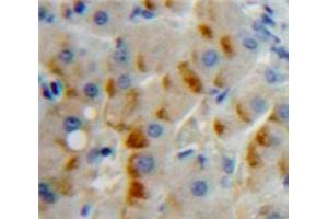 Used in DAB staining on fromalin fixed paraffin-embedded Liver tissue (CD79b antibody  (AA 26-225))