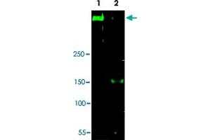 Western blot using ATR polyclonal antibody  in HeLa cell nuclear extract (Lane 1). (ATR antibody  (AA 262-277))