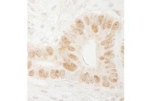 Immunohistochemistry (IHC) image for anti-CTF18, Chromosome Transmission Fidelity Factor 18 Homolog (CHTF18) (AA 25-75) antibody (ABIN7453651)
