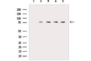anti-Heat Shock 70kDa Protein 9 (Mortalin) (HSPA9) (C-Term) antibody