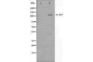 Western blot analysis on 293 cell lysate using XPF Antibody.