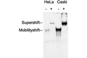 Anti-AP2 alpha/beta Antibody was used in an Electrophoretic Mobility Shift Assay (EMSA) to supershift the protein-DNA complex. (AP2 alpha/beta (C-Term) antibody)
