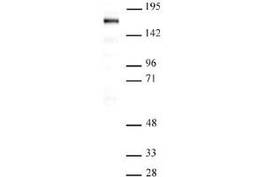 Western Blot: Nuclear extract of Saos-2 cells (20 µg per lane) probed with the SIP1 antibody (mAb) at a dilution of 1 µg/ml. (SIP1 antibody  (AA 1-360))