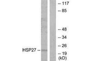 Western blot analysis of extracts from HeLa cells, using HSP27 (Ab-15) Antibody. (HSP27 antibody  (AA 5-54))