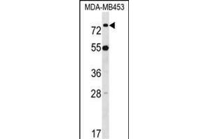 LDB3 Antibody (Center) (ABIN1538145 and ABIN2848672) western blot analysis in MDA-M cell line lysates (35 μg/lane). (LIM Domain Binding 3 Protein antibody  (AA 235-262))