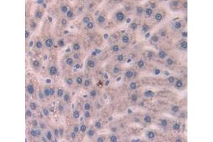 IHC-P analysis of Rat Tissue, with DAB staining. (AMBP antibody  (AA 20-202))