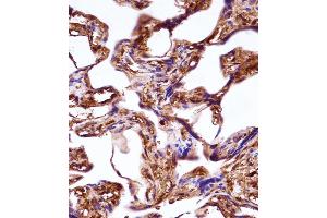 WNT3A Antibody immunohistochemistry analysis in formalin fixed and paraffin embedded human placenta tissue followed by peroxidase conjugation of the secondary antibody and DAB staining.