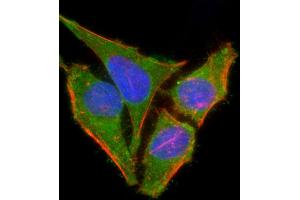 Immunofluorescent analysis of 4 % paraforldehyde-fixed, 0. (TR4 antibody  (Ser439))