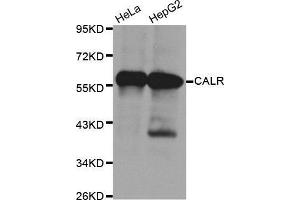 Western Blotting (WB) image for anti-Calreticulin (CALR) antibody (ABIN6214923) (Calreticulin antibody)