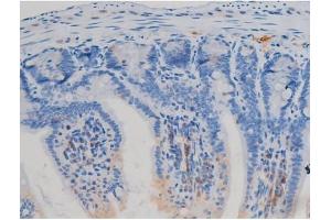Immunohistochemistry (IHC) image for anti-Nitric Oxide Synthase 3 (Endothelial Cell) (NOS3) (pSer1177) antibody (ABIN6256115)