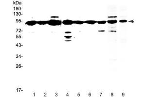 Western blot testing of human 1) HeLa, 2) placenta, 3) MCF7, 4) HepG2, 5) A549, 6) SKOV3, 7) PANC-1 and 8) mouse testis and 9) rat testis lysate with XRCC1 antibody at 0. (XRCC1 antibody)