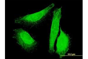 Immunofluorescence of purified MaxPab antibody to UNC84A on HeLa cell. (SUN1 antibody  (AA 1-257))