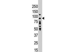 Western blot analysis of PRKCD polyclonal antibody  in placenta lysate . (PKC delta antibody  (N-Term))