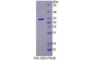 SDS-PAGE analysis of Human GNb3 Protein.