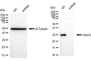 Western blotting analysis using NQO2 antibody (ABIN7799626). (Recombinant NQO2 antibody)
