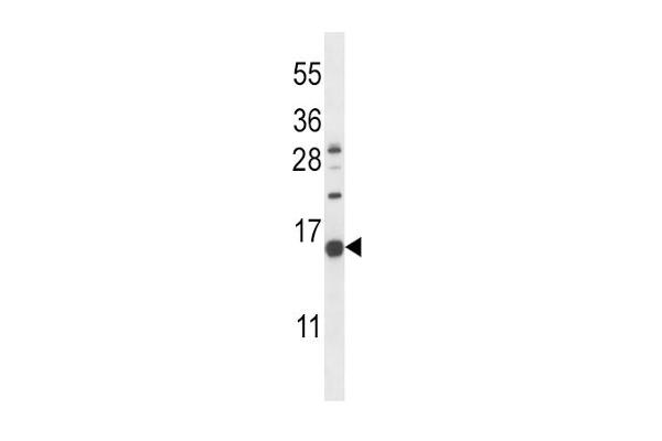 NPPC antibody  (C-Term)