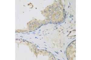 Immunohistochemistry of paraffin-embedded human prostate using LLGL2 antibody at dilution of 1:200 (40x lens).