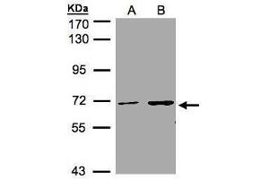 WB Image Sample(30 μg of whole cell lysate) A:A431, B:H1299 7. (CDYL antibody  (C-Term))