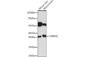 Western blot analysis of extracts of various cell lines, using TIMM50 Rabbit mAb (ABIN1513120, ABIN3022092, ABIN3022093 and ABIN7101443) at 1:1000 dilution. (TIMM50 antibody)