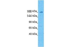 Western Blotting (WB) image for anti-Kinesin Family Member 21A (KIF21A) (N-Term) antibody (ABIN2778198) (KIF21A antibody  (N-Term))