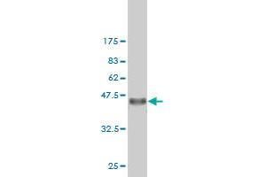 Western Blot detection against Immunogen (36. (Exportin 2 antibody  (AA 872-971))