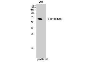 Western Blotting (WB) image for anti-Tryptophan Hydroxylase 1 (TPH1) (pSer58) antibody (ABIN3173282) (Tryptophan Hydroxylase 1 antibody  (pSer58))