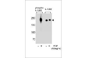 Western blot analysis of extracts from A431 cells,untreated or treated with EGF,100 ng/mL , using phospho-ERBB2-p(L)(left) or ERBB2 Antibody (right) (ErbB2/Her2 antibody  (pTyr1248))