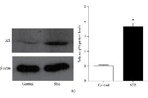 Western Blotting (WB) image for anti-Cyclin-Dependent Kinase Inhibitor 1A (p21, Cip1) (CDKN1A) (AA 43-142) antibody (ABIN3022006)