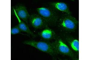 IF analysis of PAK1 using anti-PAK1 antibody (ABIN7599852).