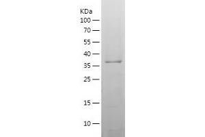 Western Blotting (WB) image for DPH1 Homolog (DPH1) (AA 89-239) protein (His-IF2DI Tag) (ABIN7283154) (DPH1 Protein (AA 89-239) (His-IF2DI Tag))