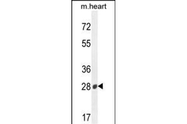 B3GAT2 antibody  (AA 123-150)