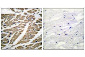 Immunohistochemistry (IHC) image for anti-Sodium Channel (Internal Region), (pan) antibody (ABIN1848776) (Sodium Channel antibody  (Internal Region, pan))