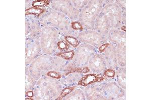 Immunohistochemistry of paraffin-embedded rat kidney using UGT2B15 antibody (ABIN7271194) at dilution of 1:100 (40x lens). (UGT2B15 antibody  (AA 60-190))