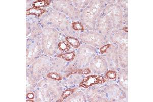 Immunohistochemistry of paraffin-embedded rat kidney using UGT2B15 antibody (ABIN7271194) at dilution of 1:100 (40x lens).